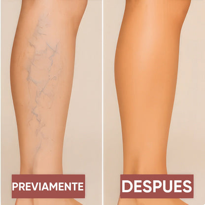 AIRLEGS LUX – Piernas de Modelo en 1 Minuto